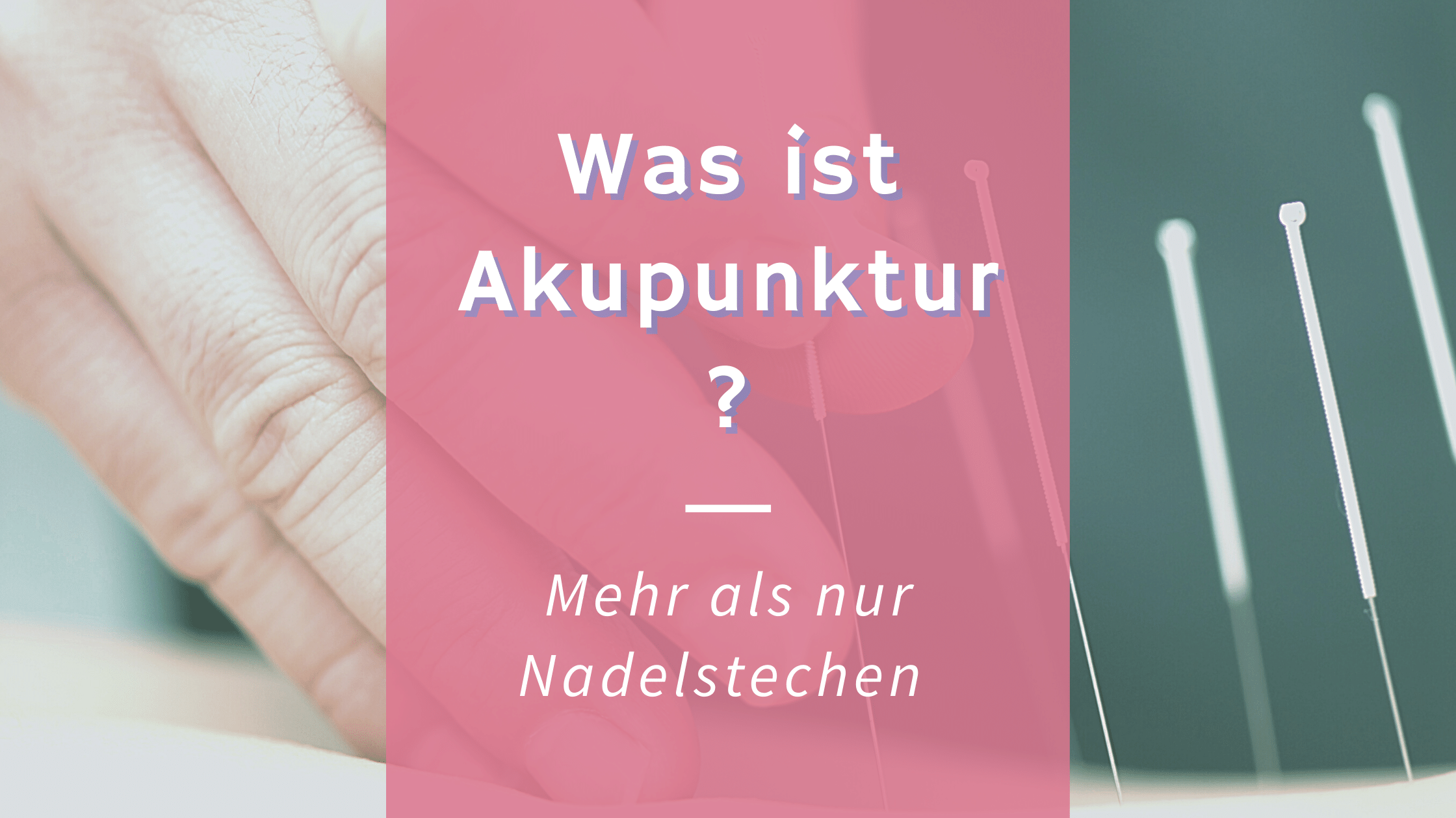 Read more about the article Was ist Akupunktur?